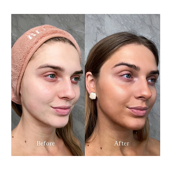 Ser autobronzant cu acid hyaluronic gradual face tanning serum