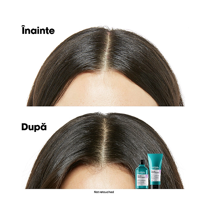 Sampon pentru scalp sensibil cu niacinamide serie expert scalp advanced