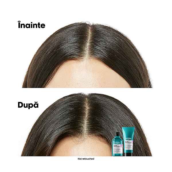 Sampon pentru scalp sensibil cu niacinamide serie expert scalp advanced