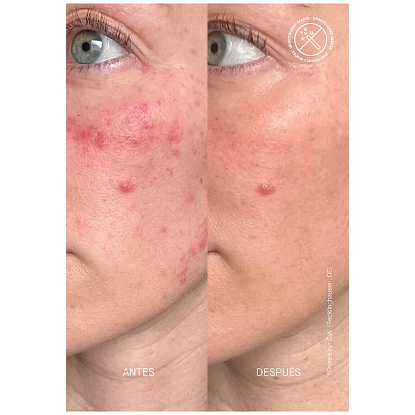 Serum reparator 3% ceramide