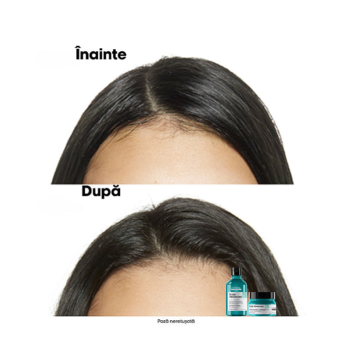 Sampon profesional pentru scalp gras cu 4% aha serie expert scalp advanced