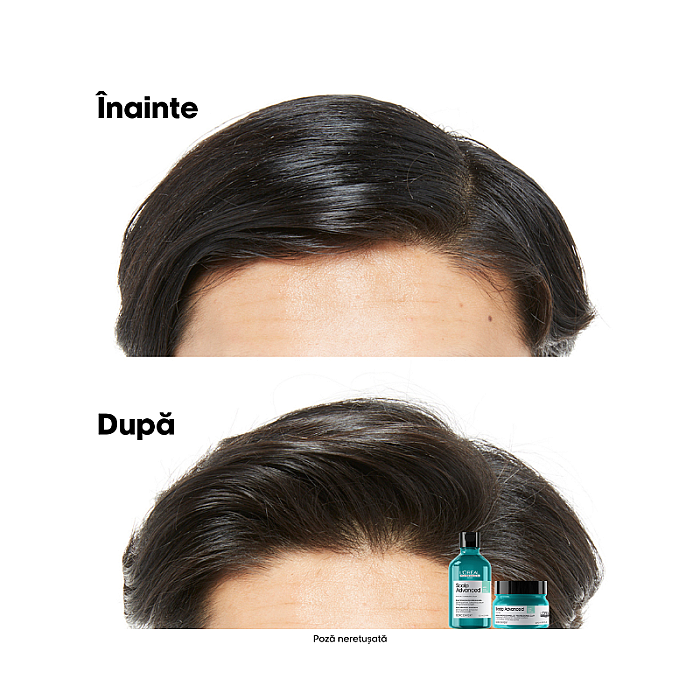 Sampon profesional pentru scalp gras cu 4% aha serie expert scalp advanced