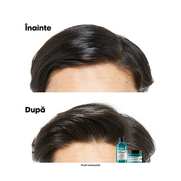 Sampon profesional pentru scalp gras cu 4% aha serie expert scalp advanced