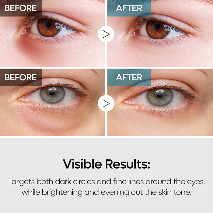 Crema anti-rid pentru ochi cu Retinal si TranEX-1