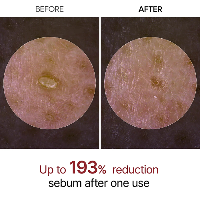 Serum exfoliant cu orez negru pentru ingrijirea porilor Peel Shot