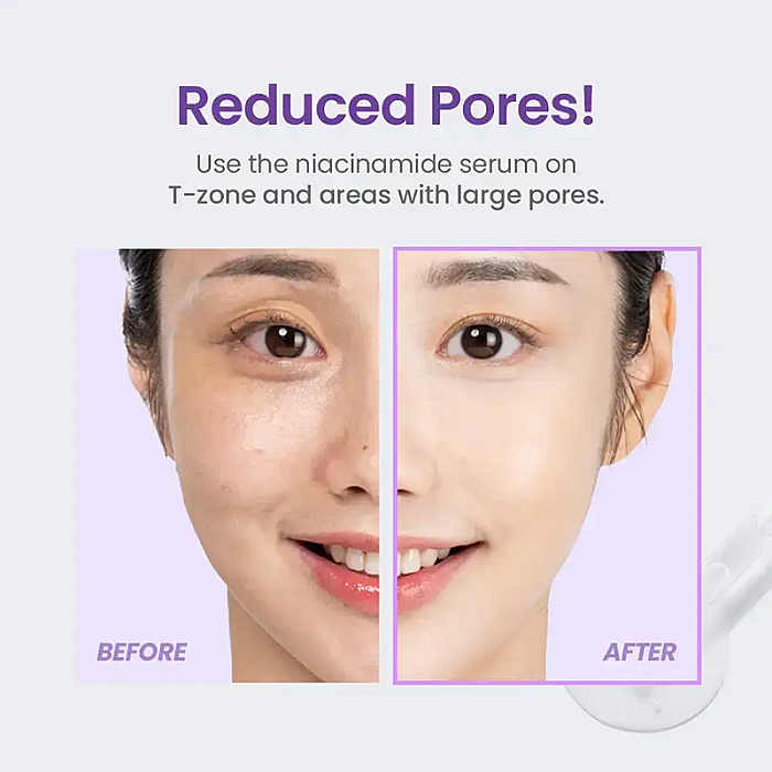 Ser de fata pentru iluminare si fermitate cu niacinamide 20% si retinol