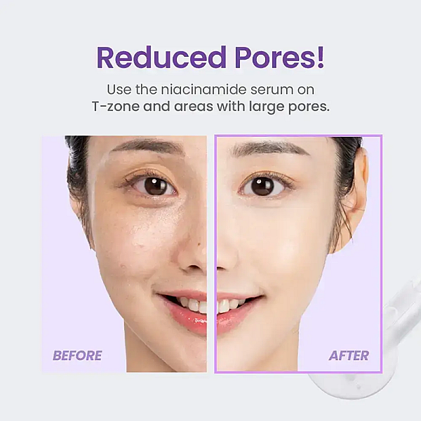 Ser de fata pentru iluminare si fermitate cu niacinamide 20% si retinol