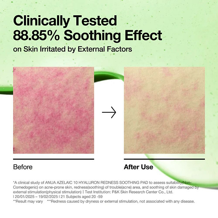 Dischete tonice calmante anti-roseata pentru ten sensibil Azelaic 10 Hyaluron Redness Soothing Pad