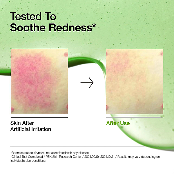 Ser calmant anti-roseata pentru piele sensibila Azelaic Acid 10 Hyaluron Redness Soothing