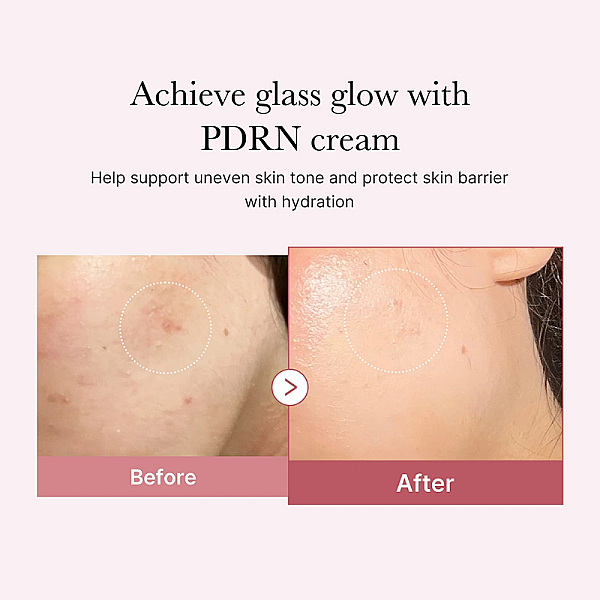 Crema de fata hidratanta cu PDRN si Acid Hialuronic PDRN Pink Hyaluronic