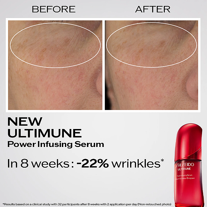 Ser anti-aging fortifiant Ultimune Power Infusing Serum
