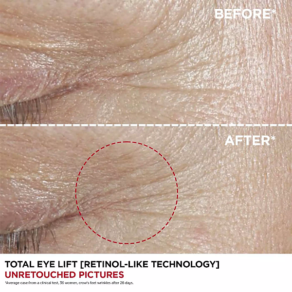 Serum pentru conturul ochilor Total Eye Lift