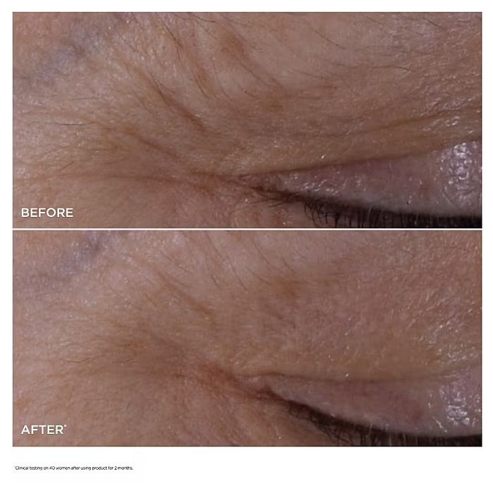 Serum pentru conturul ochilor Double Serum Global Age-Defying Concentrate