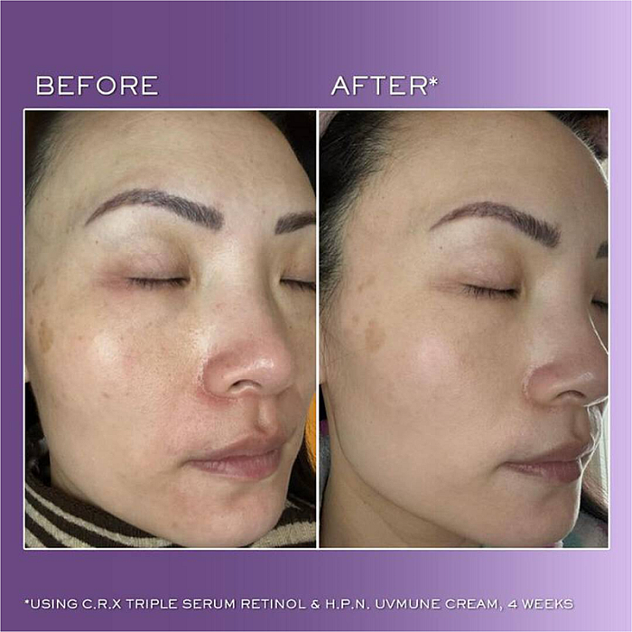 Ser de noapte anti-rid cu retinol Renergie C.R.x. Triple Serum Retinol