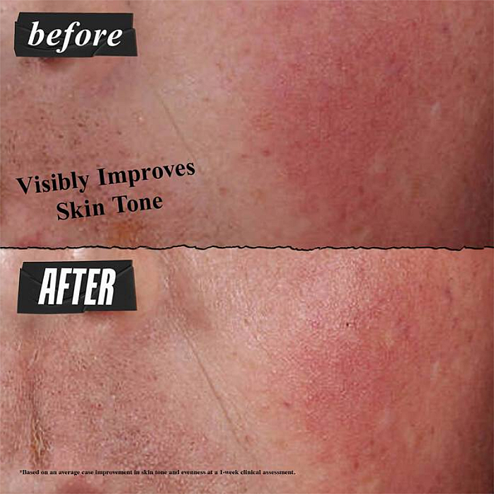 Crema hidratanta pentru repararea barierei pielii Ultra Facial Advanced Repair Barrier Cream