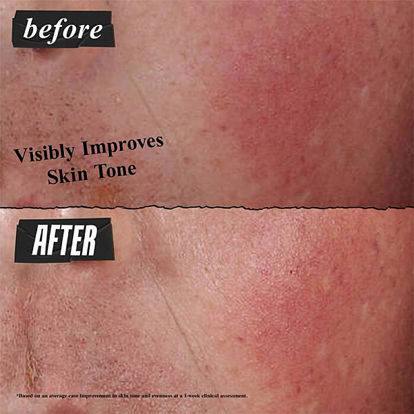 Crema hidratanta pentru repararea barierei pielii Ultra Facial Advanced Repair Barrier Cream