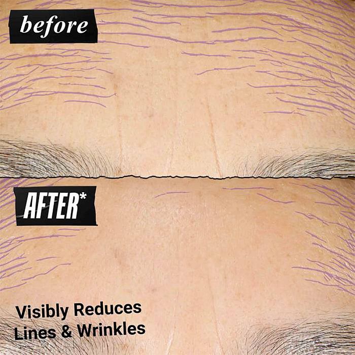 Ser zilnic antirid Retinol Skin-Renewing Daily Micro-Dose Serum
