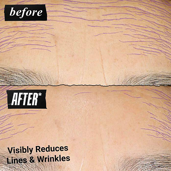 Ser zilnic antirid Retinol Skin-Renewing Daily Micro-Dose Serum