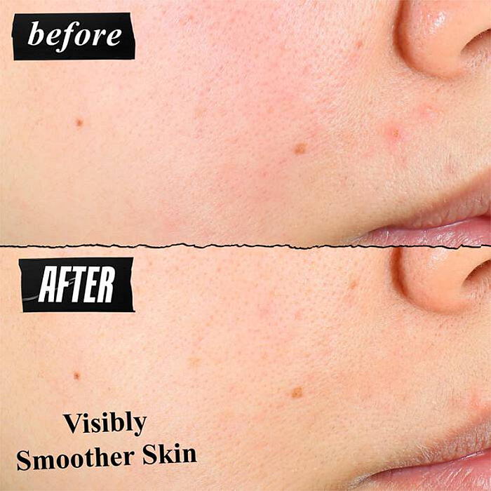 Exfoliant bland pentru fata cu AHA, BHA si PHA Clearly Corrective Daily Re-Texturizing Triple Acid Peel