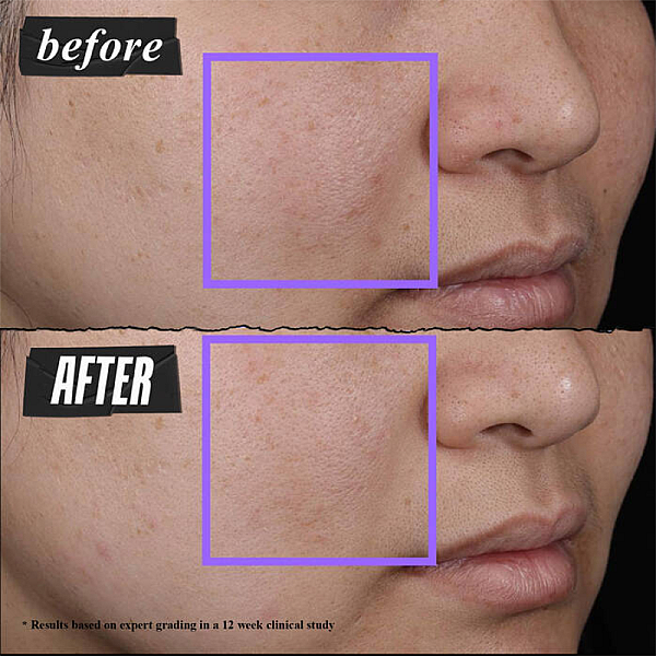 Emulsie calmanta cu Niacinamide Clearly Corrective Clarity-Activating Soothing Emulsion