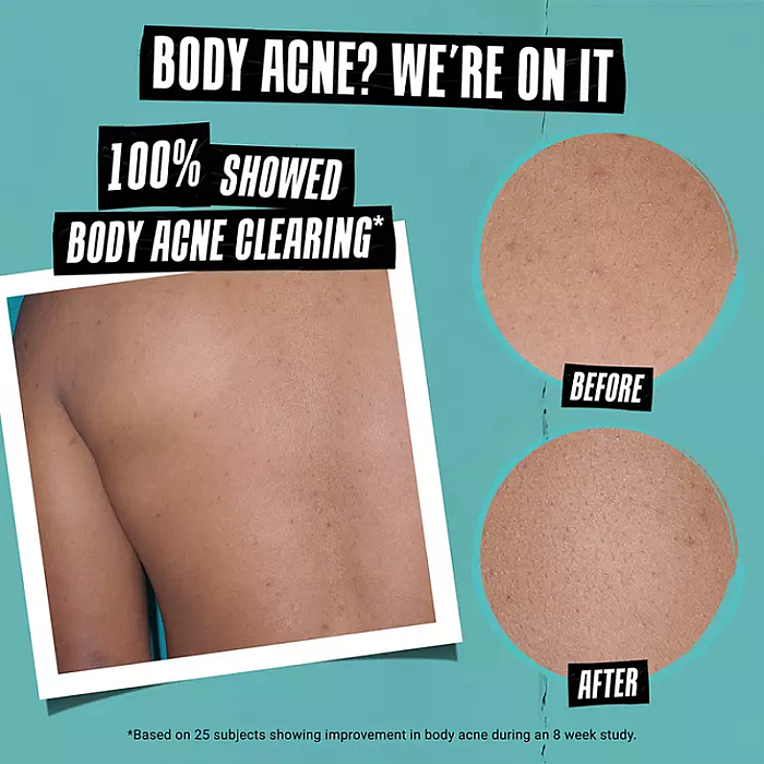 Crema anti-imperfectiuni cu acid salicilic si niacinamide Expertly Clear Blemish-Treating & Preventing Lotion