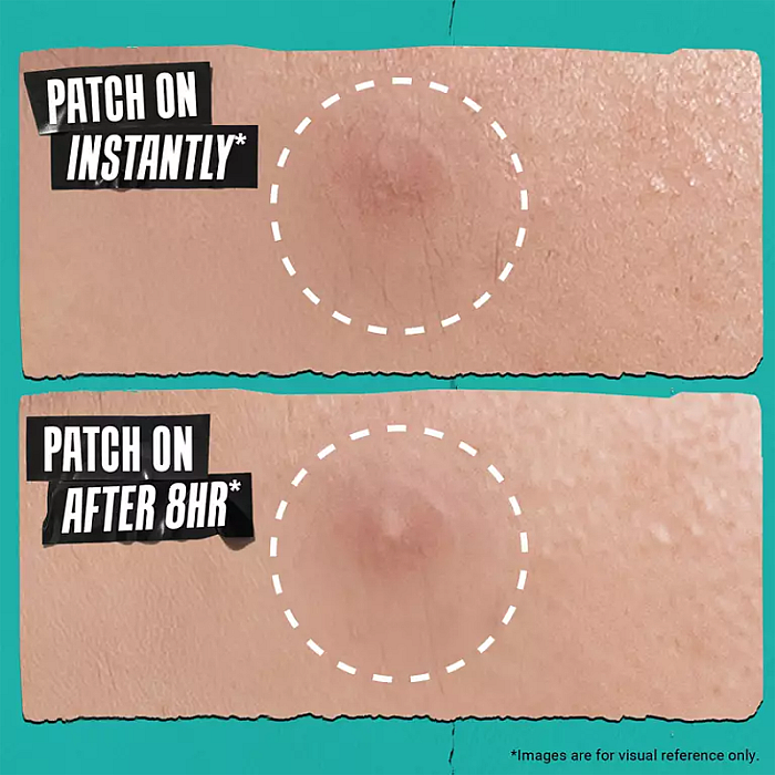 Plasturi hidrocoloidali pentru acnee Truly Targeted Overnight Blemish