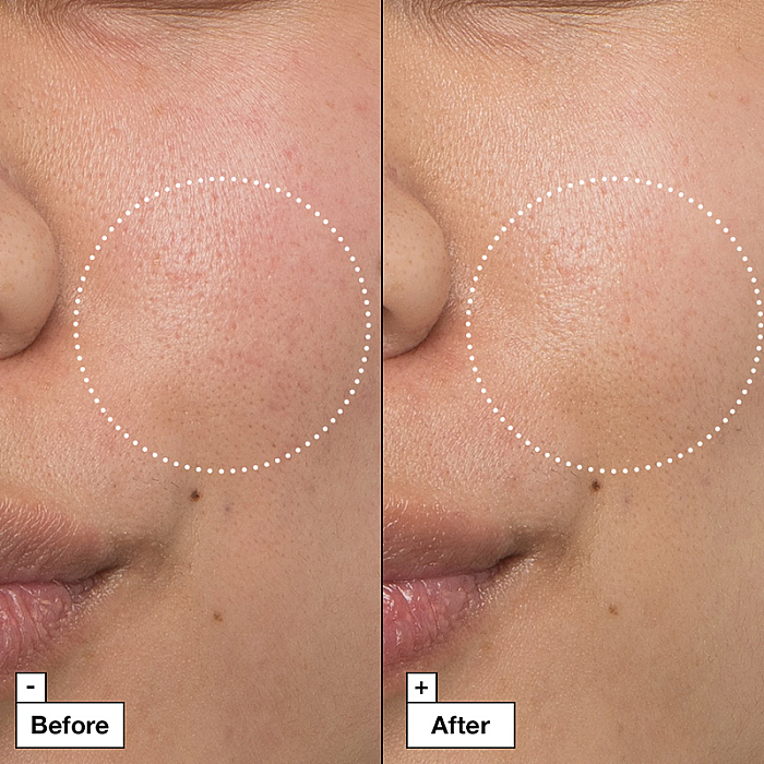Crema reparatoare si calmanta impotriva rosetii Cicapair Intensive Soothing Repair Cream