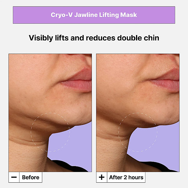 Masca de fata cu efect de lifting Cryo V-Sculpt Jawline Lifting Mask