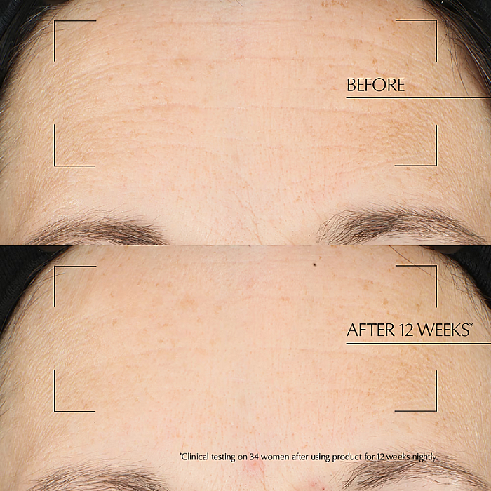 Crema tratament de noapte Advanced Night Repair Overnight Treatment