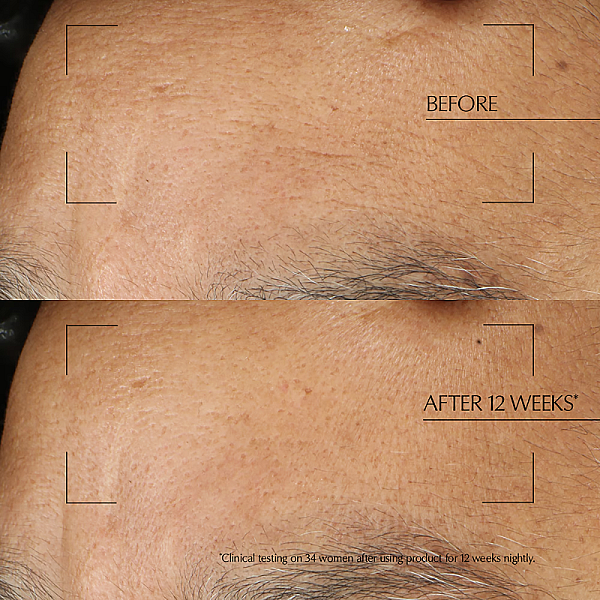 Crema tratament de noapte Advanced Night Repair Overnight Treatment