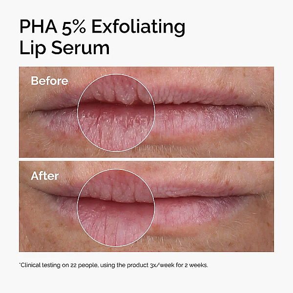 Ser exfoliant cu 5% PHA pentru buze Lip Serum
