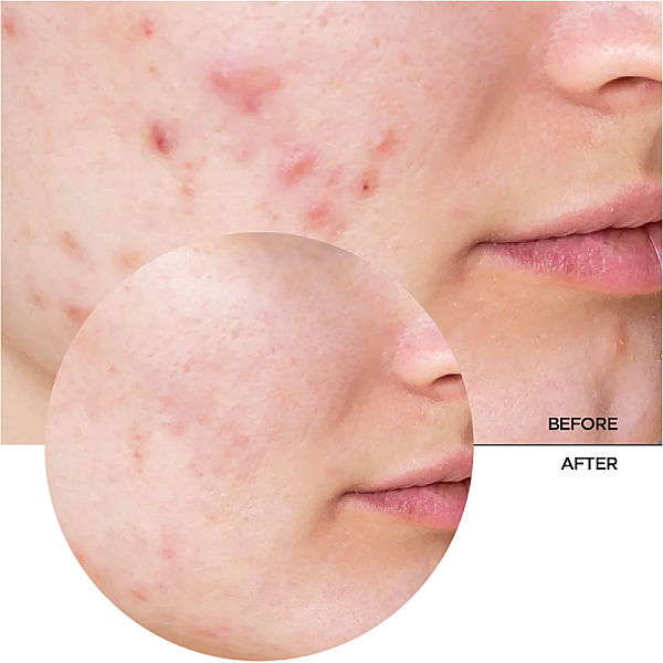 Ser hidratant cu niacinamide Just Niacinamide 10%