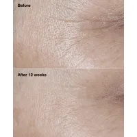 Crema antirid cu SPF 30 Smart Clinical Repair Wrinkle Correcting Cream