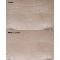 Crema antirid cu SPF 30 Smart Clinical Repair Wrinkle Correcting Cream