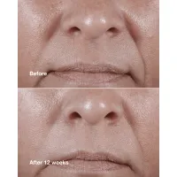 Crema antirid intens hidratanta Smart Clinical Repair Wrinkle Correcting Rich Cream