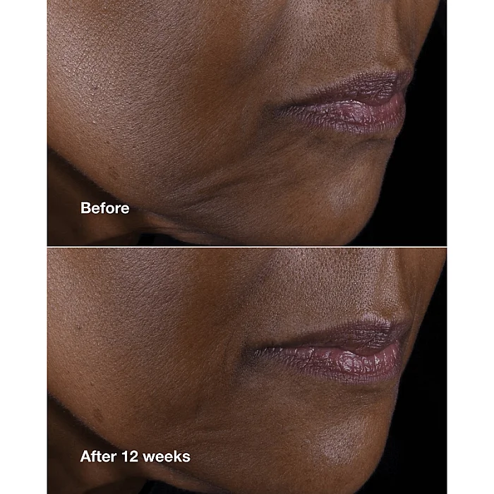 Crema anti-imbatranire pentru fata si gat Smart Clinical Repair Lifting