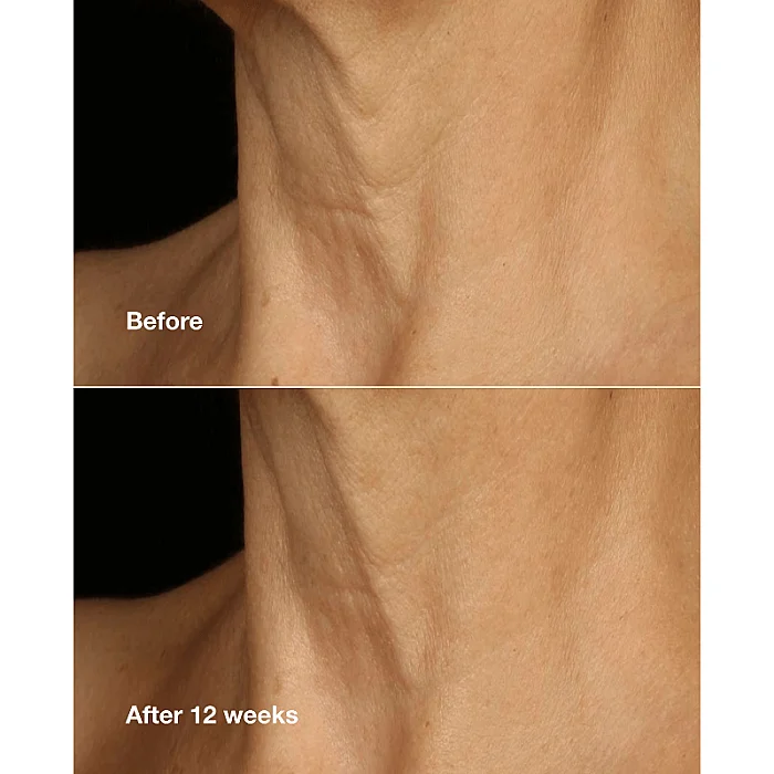 Crema anti-imbatranire pentru fata si gat Smart Clinical Repair Lifting