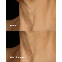 Crema anti-imbatranire pentru fata si gat Smart Clinical Repair Lifting