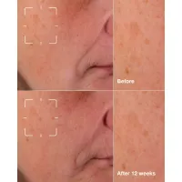 Ser iluminator anti-pete Even Better Clinical Dark Spot Clearing