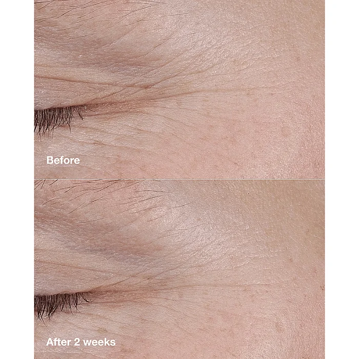 Balsam solid anti-rid cu 1% retinoid si acid hialuronic Smart Clinical Repair AM/PM Retinoid Balm