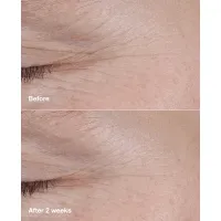 Balsam solid anti-rid cu 1% retinoid si acid hialuronic Smart Clinical Repair AM/PM Retinoid Balm