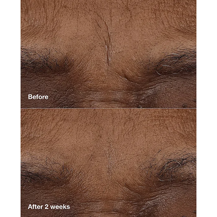 Balsam solid anti-rid cu 1% retinoid si acid hialuronic Smart Clinical Repair AM/PM Retinoid Balm