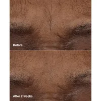 Balsam solid anti-rid cu 1% retinoid si acid hialuronic Smart Clinical Repair AM/PM Retinoid Balm