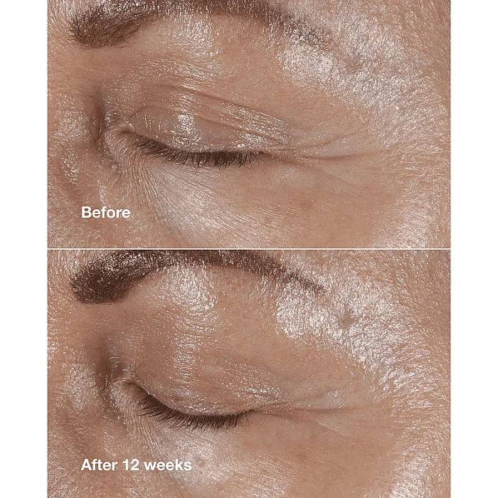Crema antirid pentru conturul ochilor Smart Clinical Repair Wrinkle Correcting Eye Cream