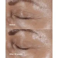 Crema antirid pentru conturul ochilor Smart Clinical Repair Wrinkle Correcting Eye Cream