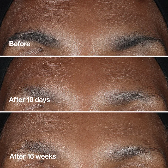 Ser concentrat antirid Smart Clinical Repair Wrinkle Correcting Serum
