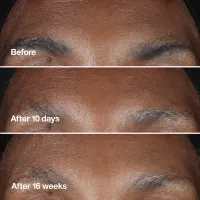 Ser concentrat antirid Smart Clinical Repair Wrinkle Correcting Serum