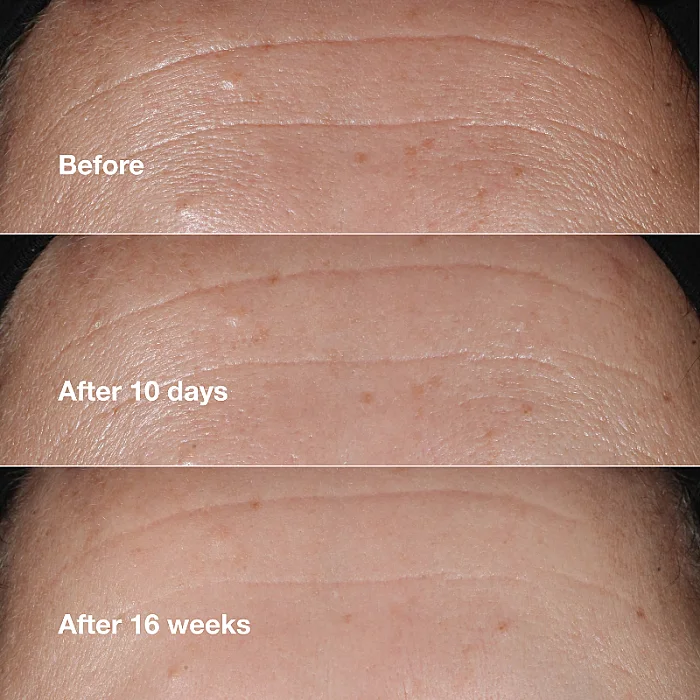 Ser concentrat antirid Smart Clinical Repair Wrinkle Correcting Serum