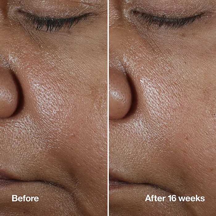 Ser concentrat antirid Smart Clinical Repair Wrinkle Correcting Serum