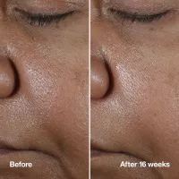 Ser concentrat antirid Smart Clinical Repair Wrinkle Correcting Serum